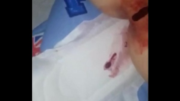 Akhirnya Merasakan Pecah Perawan