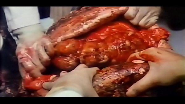 Devil Fetus 2 (1984) One Of Hong Kong’s Most Notorious And Disgusting Black Magic Horror Flicks